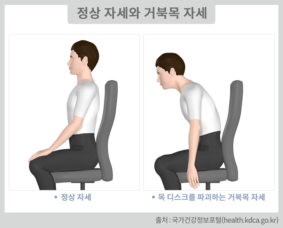 정상 자세와 거북목 자세