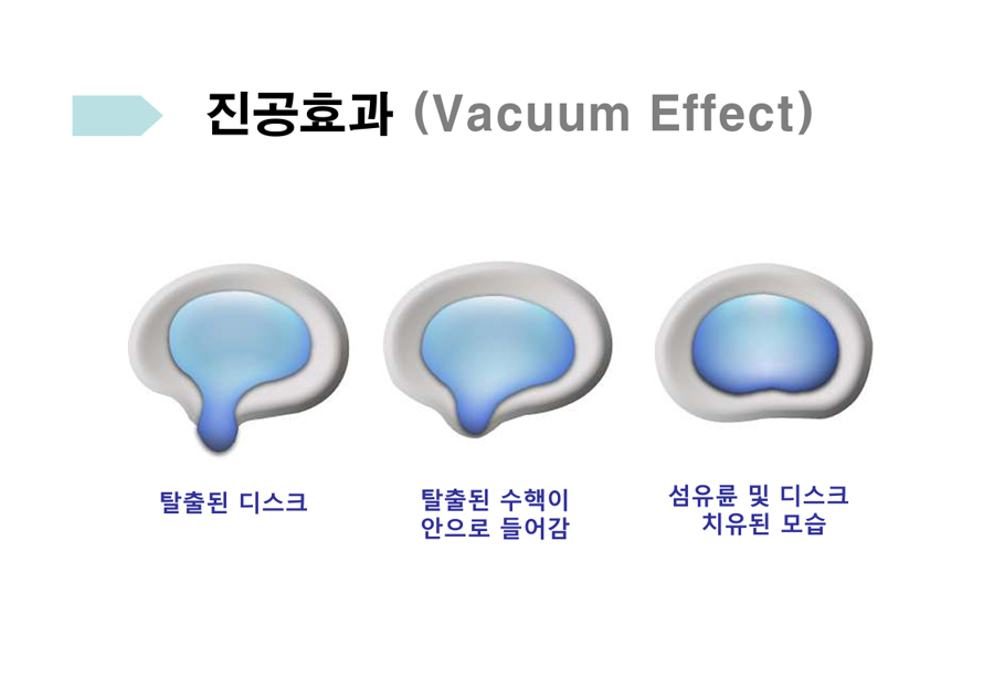 진공효과