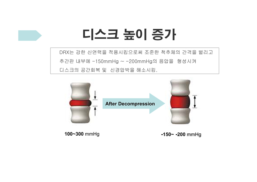 디스크 높이 증가