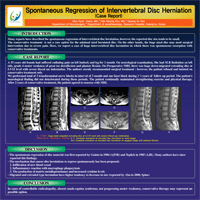 제 22차 대한척추신경외과학회 정기학술대회 - 포스터 발표 이미지