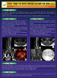 제 50차 대한통증학회 학술대회 및 연수 교육 - 포스터발표 이미지